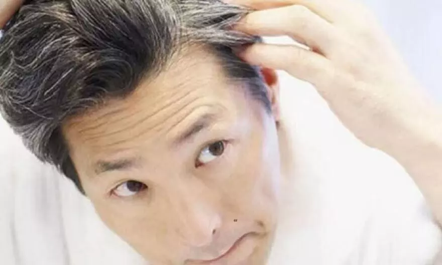 अगर आपके बाल भी समय से पहले होने लगे हैं सफेद तो, ये टिप्स जादू की तरह करेंगी काम