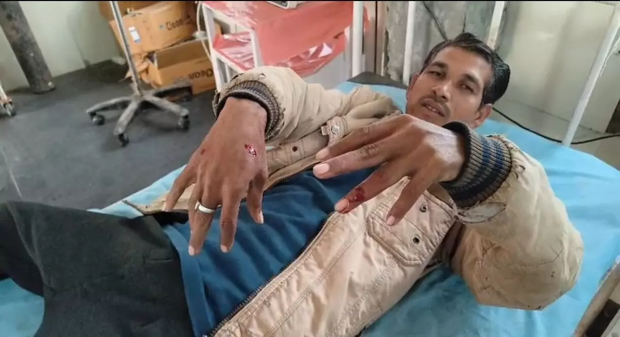 जंगली सियार के काटने से दो लोग हुए घायल