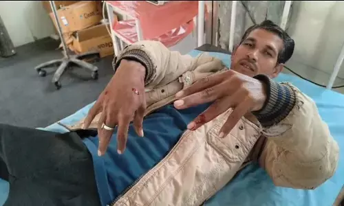 जंगली सियार के काटने से दो लोग हुए घायल जंगली सियार के काटने से दो लोग हुए घायल