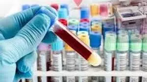 लैबोरेटरी में बिना डॉक्टर जांच का मामला उजागर लैबोरेटरी में बिना डॉक्टर जांच का मामला उजागर