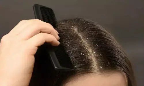 सिर्फ शैंपू से नहीं जा रहे हैं डैंड्रफ? तो इन घरेलू चीजों को जरूर करें इस्तेमाल, जल्द नजर आएगा असर सिर्फ शैंपू से नहीं जा रहे हैं डैंड्रफ? तो इन घरेलू चीजों को जरूर करें इस्तेमाल, जल्द नजर आएगा असर