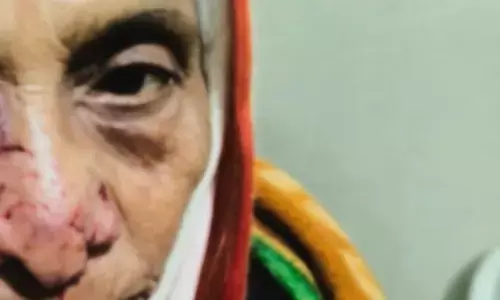 पागल लोमड़ी के हमले में बुजुर्ग महिला गंभीर रूप से घायल, गांव में दहशत का माहौल