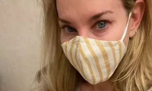 भयंकर बीमारी के चलते अमेरिकी महिला बन गई छिपकली, शरीर का हो गया ऐसा हाल, जानकर दंग रह जाएंगे आप भयंकर बीमारी के चलते अमेरिकी महिला बन गई छिपकली, शरीर का हो गया ऐसा हाल, जानकर दंग रह जाएंगे आप