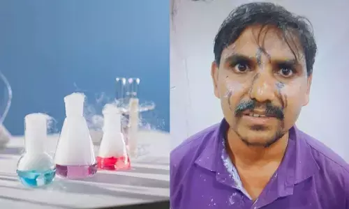 मालाड में 600 रुपए के विवाद में एसिड अटैक, 8 लोग झुलसे, एक आरोपी को किया गिरफ्तार