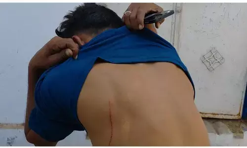 आपसी रंजिश के चलते युवक पर कुल्हाड़ी से किया वार