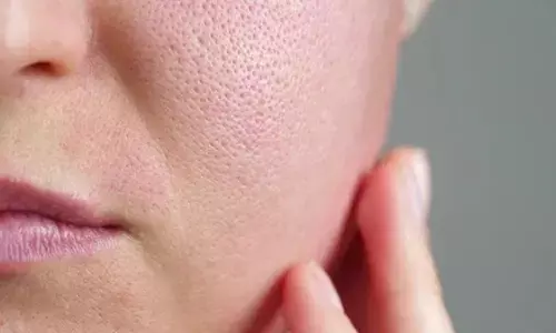 ओपेन पोर्स से हैं आप भी परेशान? तो इन आसान टिप्स की मदद से अपनी स्किन को बनाएं फ्लॉलेस ओपेन पोर्स से हैं आप भी परेशान? तो इन आसान टिप्स की मदद से अपनी स्किन को बनाएं फ्लॉलेस