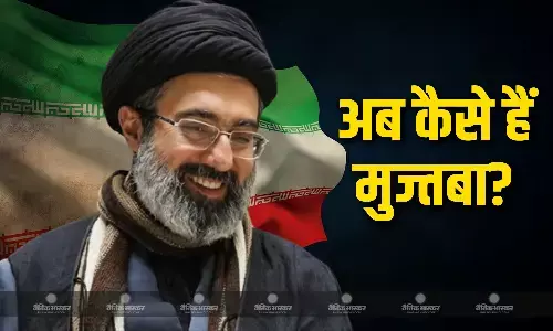 हाथ-पैर का कई बार हुआ ऑपरेशन, चेहरे पर जलने के निशान...मुज्तबा खामेनेई के स्वास्थ्य को लेकर बड़ी जानकारी