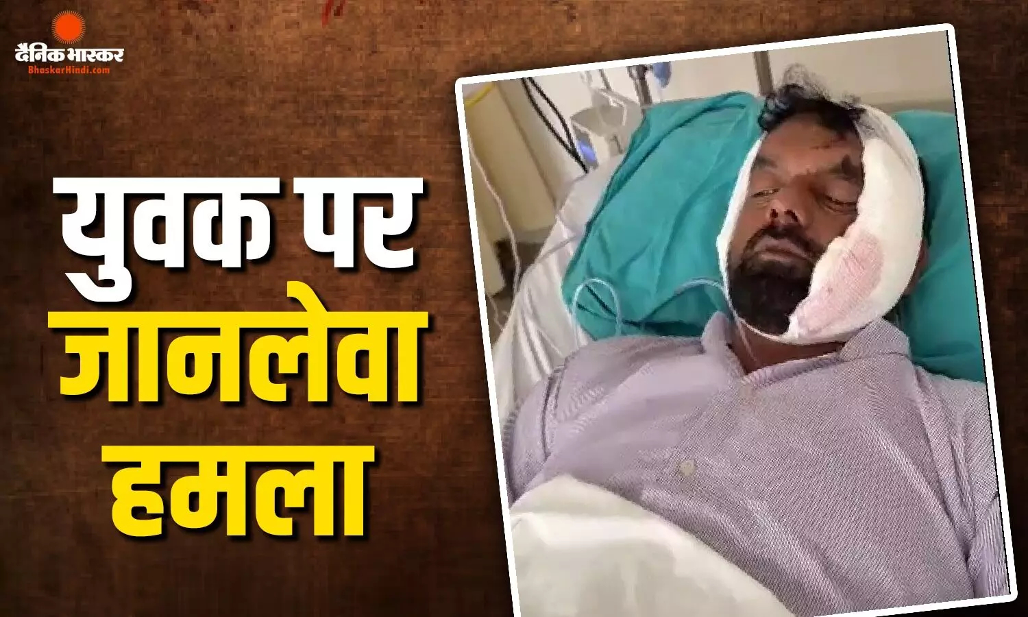 भोपाल के निसर्ग होटल में बवाल, जन्मदिन पार्टी में युवक पर बोतल से जानलेवा हमला, अस्पताल में भर्ती भोपाल के निसर्ग होटल में बवाल, जन्मदिन पार्टी में युवक पर बोतल से जानलेवा हमला, अस्पताल में भर्ती