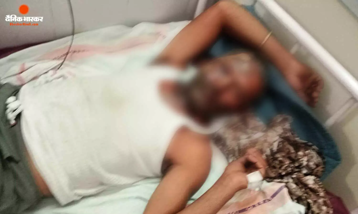 बारिश का पानी साफ करते समय 11 हजार केव्हीए हाईटेंशन लाईन की चपेट में आया किसान, गंभीर रूप से झुलसा