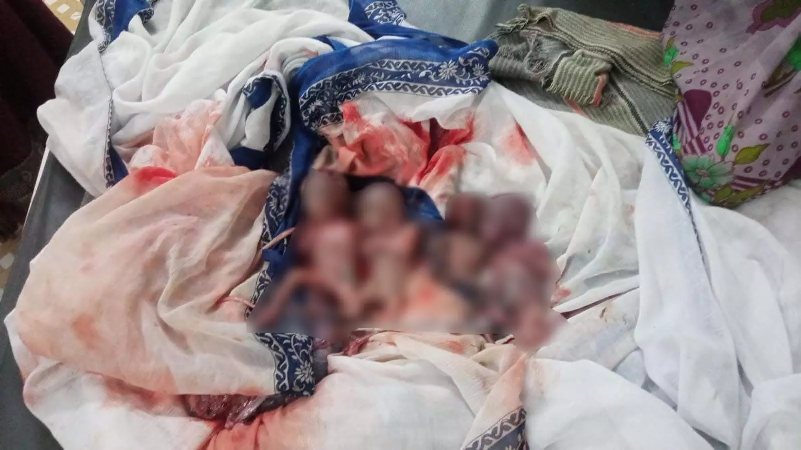ऑटो में प्रसव, एक साथ जन्मे 4 प्रीमिच्योर नवजात ऑटो में प्रसव, एक साथ जन्मे 4 प्रीमिच्योर नवजात