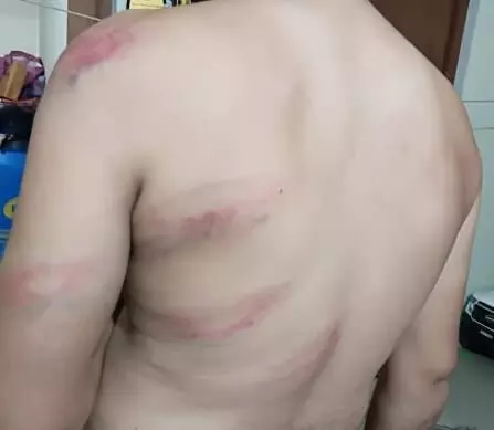 वन रक्षक के साथ डंडे से मारपीट वर्दी फाड़ी, तीन पर मामला दर्ज वन रक्षक के साथ डंडे से मारपीट वर्दी फाड़ी, तीन पर मामला दर्ज