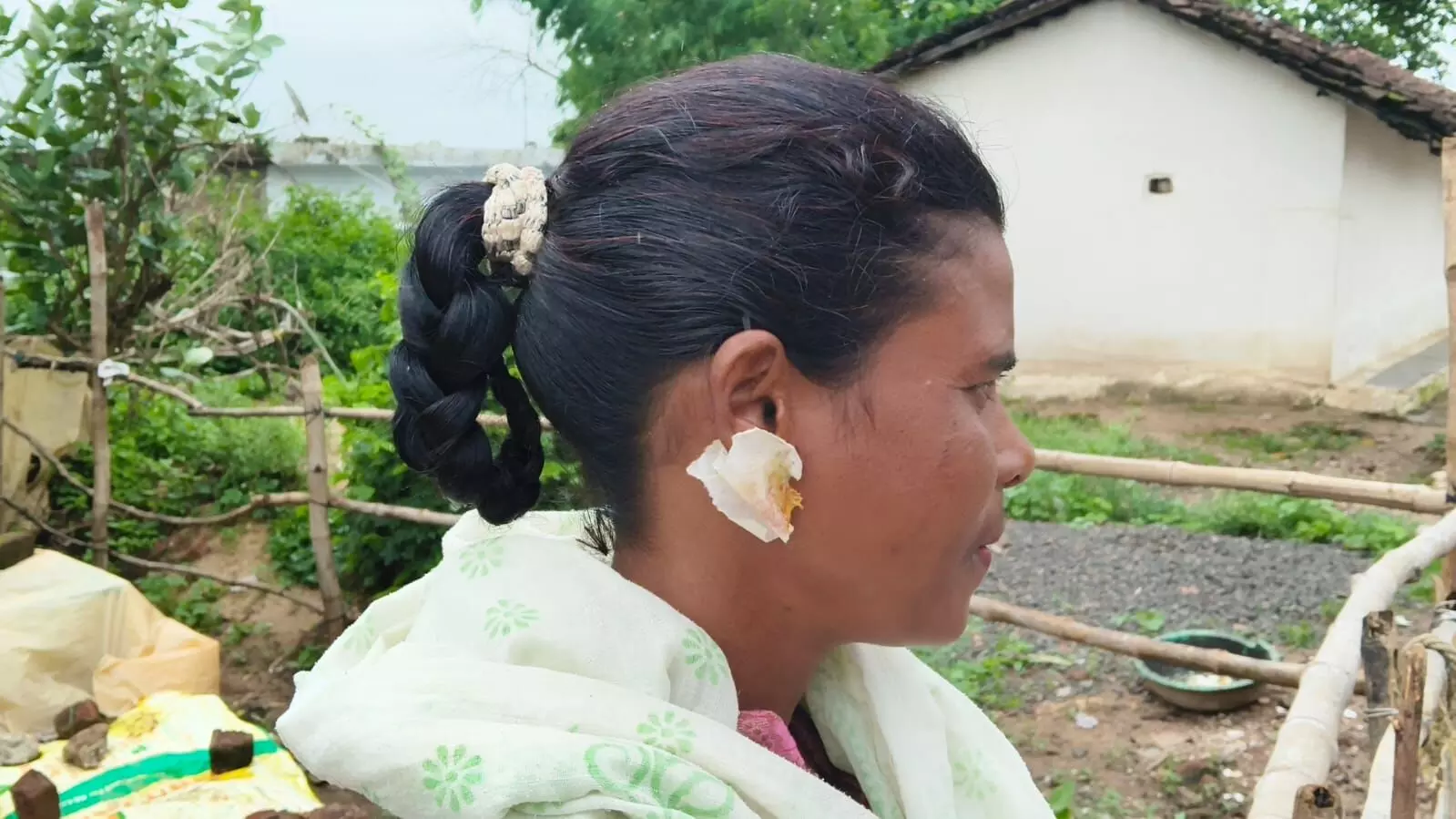 आवारा कुत्ते हुए हिंसक: हर दिन लोगों को बना रहे अपना शिकार, आवारा कुत्ते हुए हिंसक: हर दिन लोगों को बना रहे अपना शिकार,