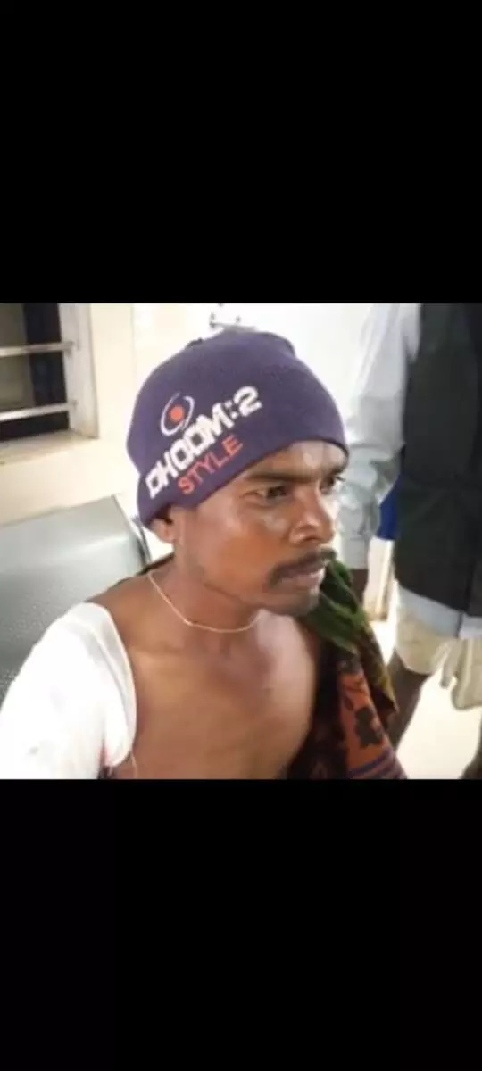 जंगल से लौट रहे युवक पर भालू का हमला जंगल से लौट रहे युवक पर भालू का हमला