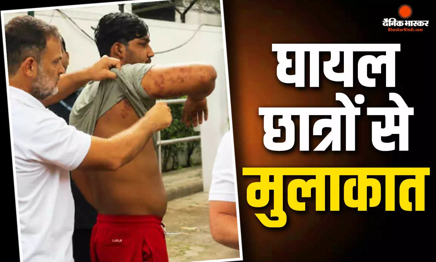 राहुल गांधी ने घायल छात्रों मुलाकात कर सरकार पर साधा निशाना, धर्मेंद्र प्रधान के इस्तीफे पर दिया जोर राहुल गांधी ने घायल छात्रों मुलाकात कर सरकार पर साधा निशाना, धर्मेंद्र प्रधान के इस्तीफे पर दिया जोर