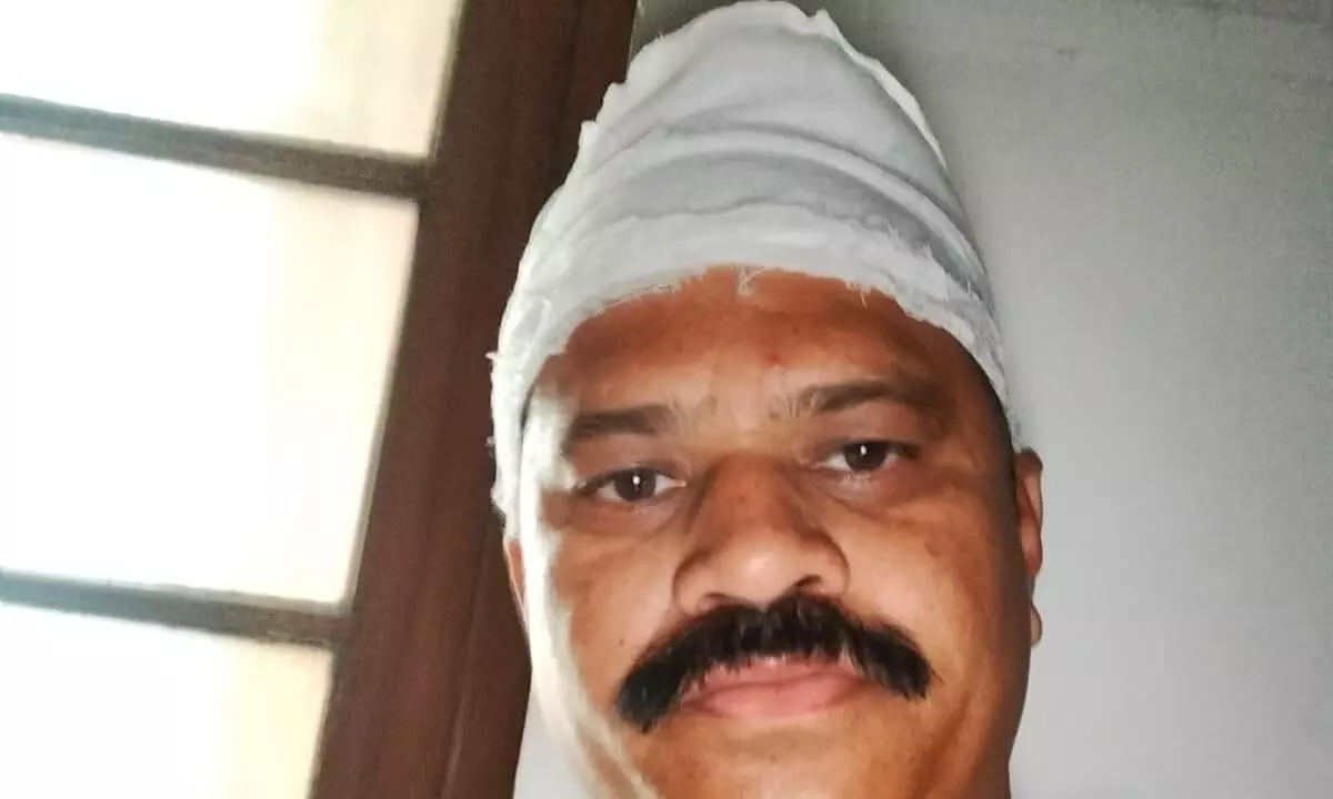राशन माफिया की सूचना मिलने पर मामले की छानबीन करने पहुंचे पत्रकार को अगवा कर दो लोहे की रॉड से पीटा