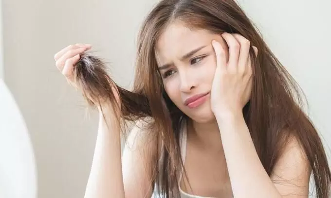 बारिश के मौसम में आपके भी झड़ रहे हैं बाल? तो इन चीजों को करें अपनी डाइट में शामिल