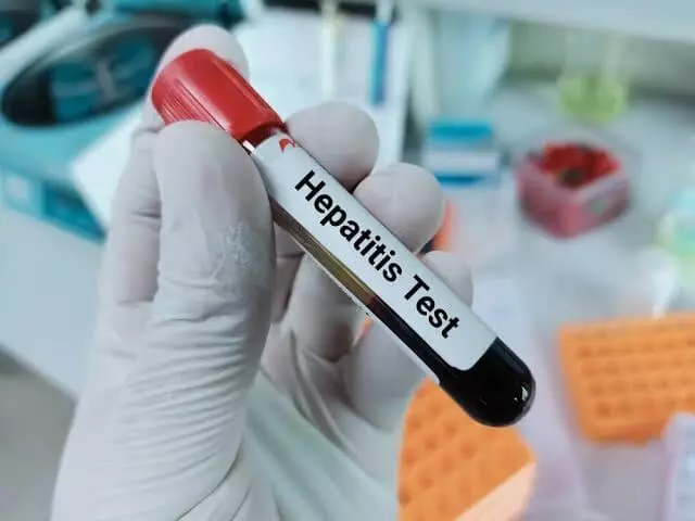 सेंट्रल जेल में हेपेटाइटिस बी-सी से पीडि़त मिले 10 बंदी सेंट्रल जेल में हेपेटाइटिस बी-सी से पीडि़त मिले 10 बंदी