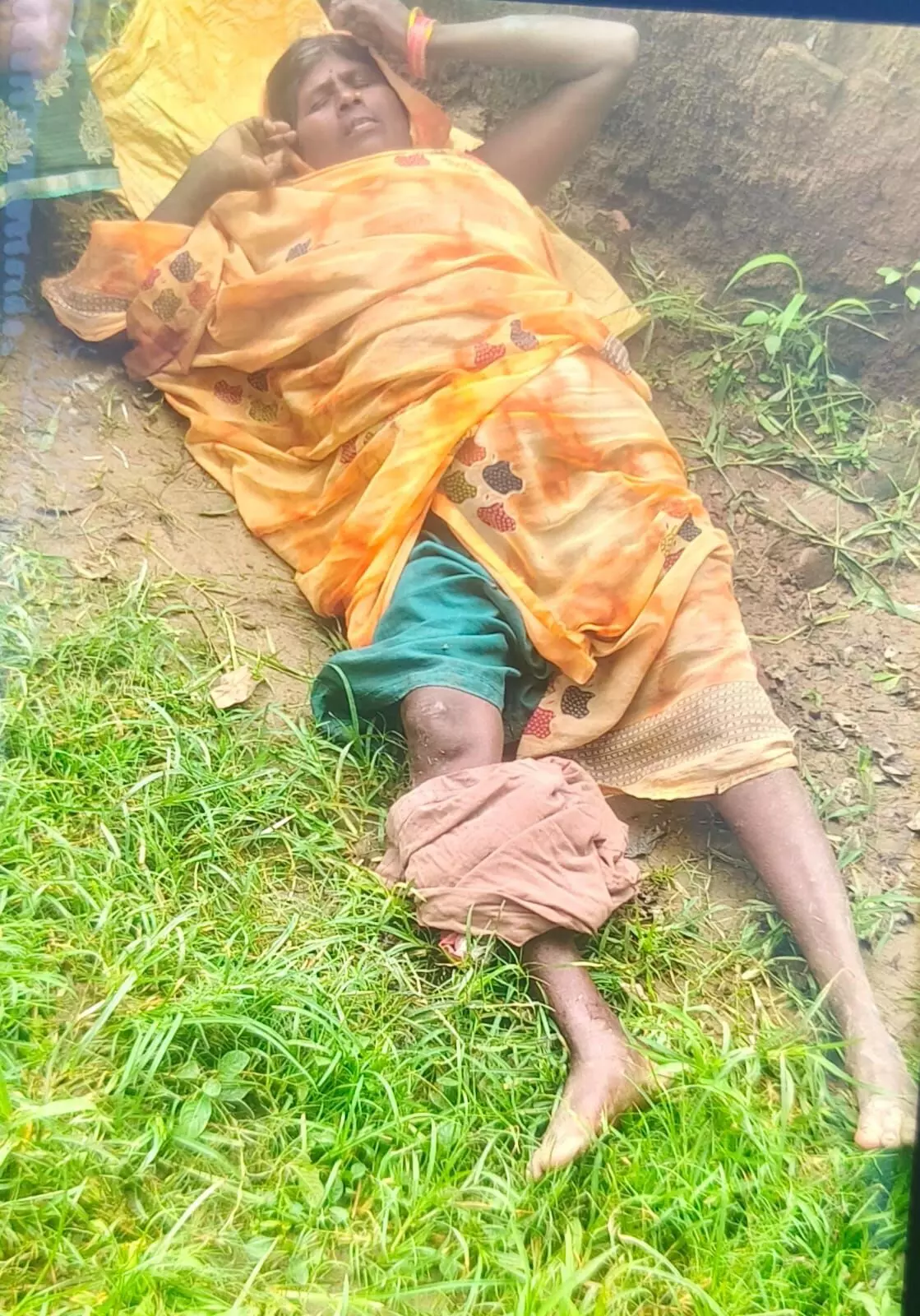 जमीन के विवाद पर महिला से मारपीट, पैर में आई गंभीर चोट जमीन के विवाद पर महिला से मारपीट, पैर में आई गंभीर चोट