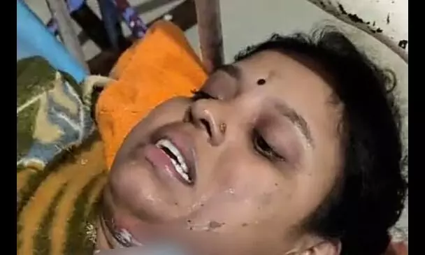 मायके से लौटी पत्नी पर पेट्रोल डालकर लगाई आग! मायके से लौटी पत्नी पर पेट्रोल डालकर लगाई आग!