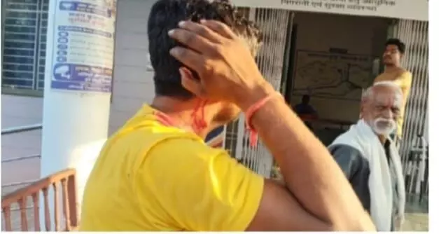त्योहारों के माहौल में शराब के नशे में बढ़ते उपद्रव और मारपीट का मामला