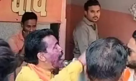 भोपाल में चंद्रशेखर तिवारी के चेहरे पर पोती स्याही, बयान पर बढ़ा विवाद